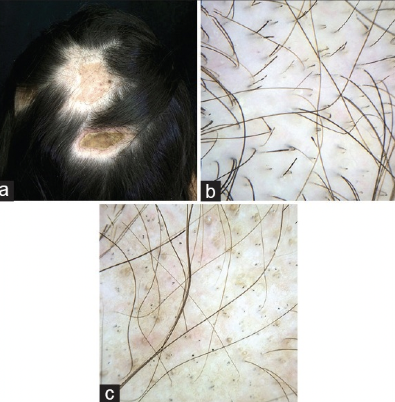 Hair Loss: What's causing my hair loss? — Donovan Hair Clinic